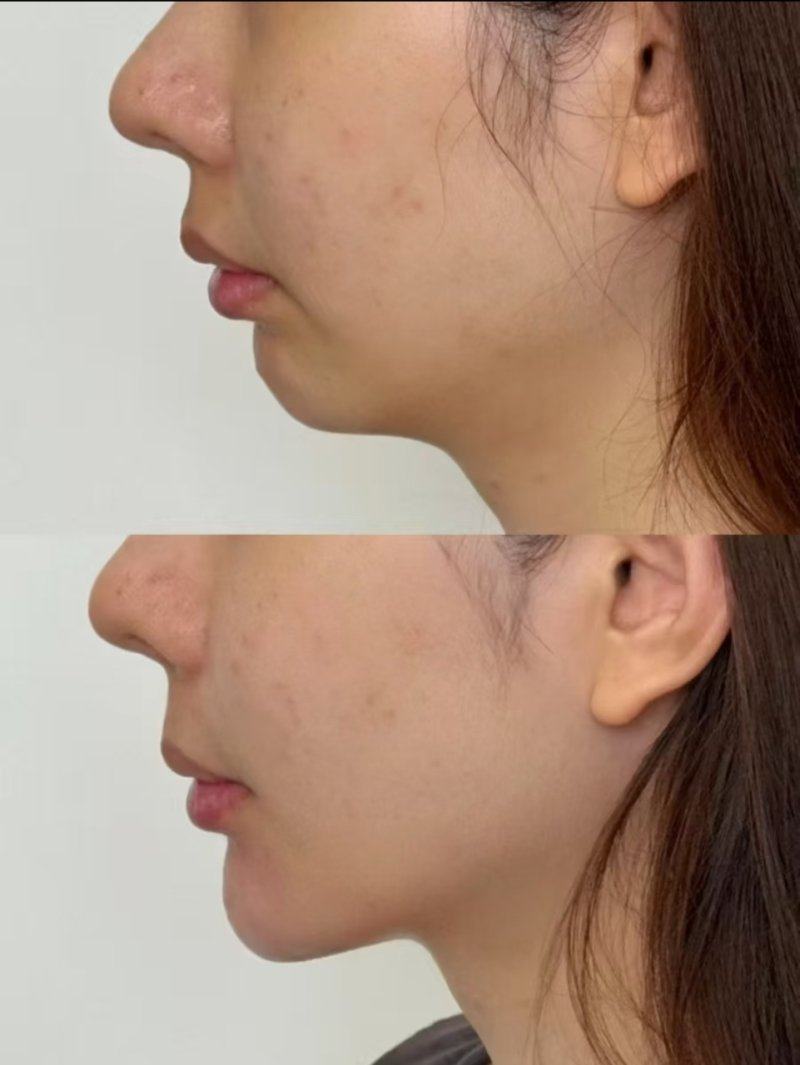 二、疤痕凝胶药膏的核心功效解析