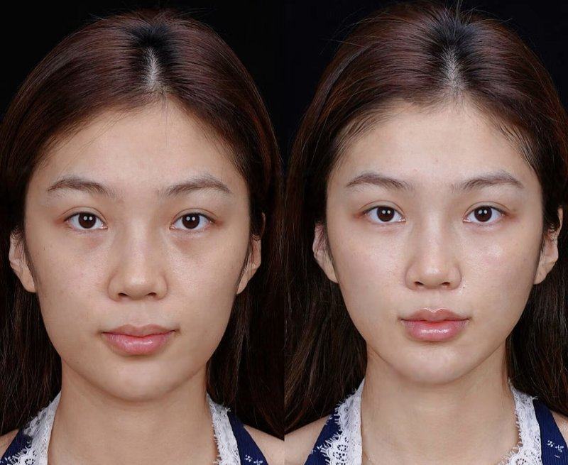 上饶芯颜整形医院价格表