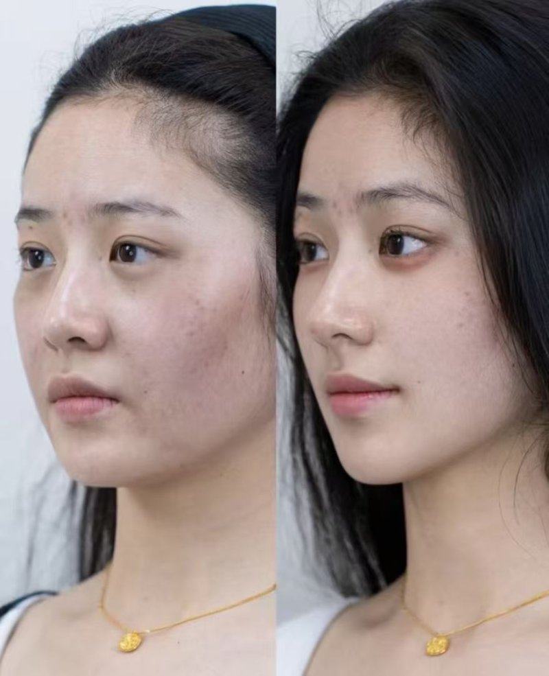 广州鸿嘉怡美医疗美容门诊部价格表