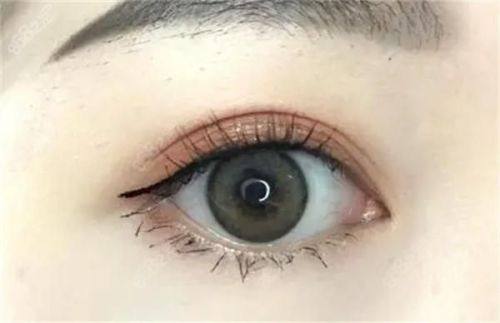 西安纽莱芙医疗美容诊所价格表: