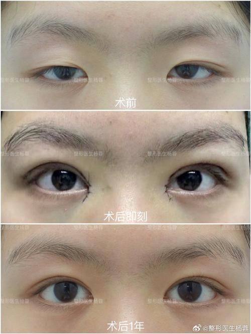 西安纽莱芙医疗美容诊所预约挂号方式: