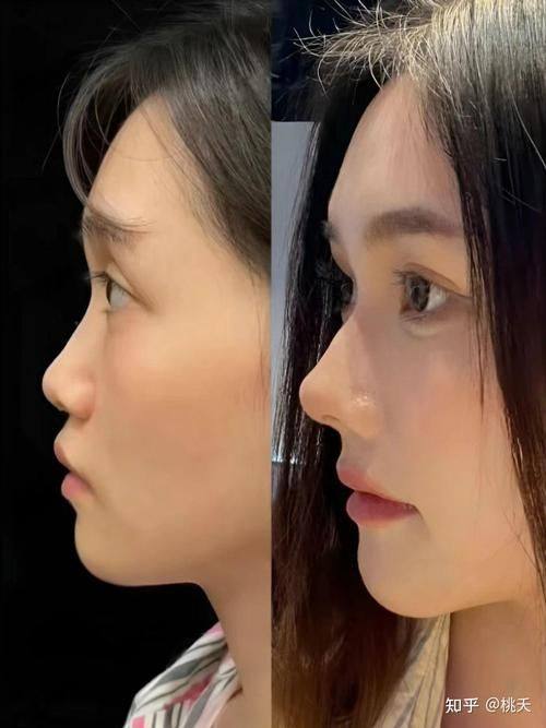 西安纽莱芙医疗美容诊所口碑评价: