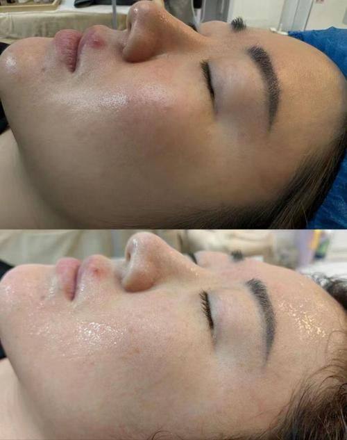 玉溪书悦整形医院预约挂号方式