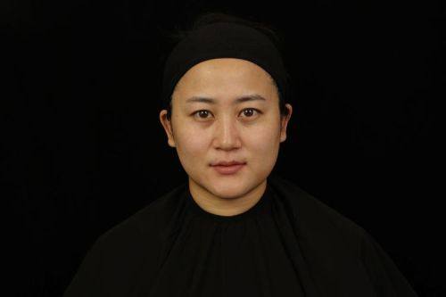 佳木斯陈红梅医疗美容门诊部擅长项目: