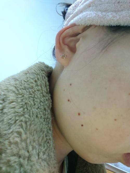 西安纽莱芙医疗美容诊所怎么样?