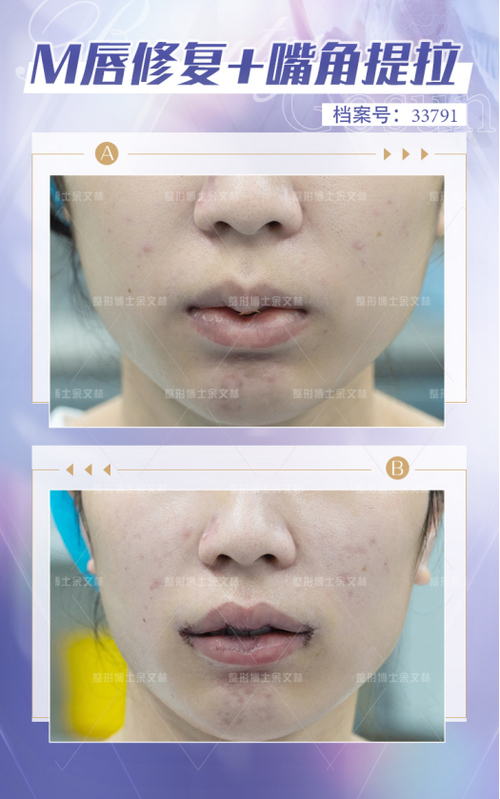 衡阳曹家医疗美容门诊部怎么样?