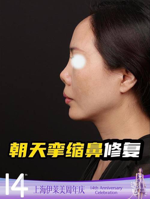 常州赫尔希医疗美容诊所擅长项目