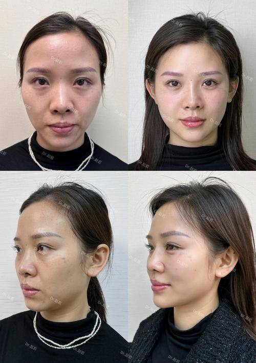 常州赫尔希医疗美容诊所口碑评价