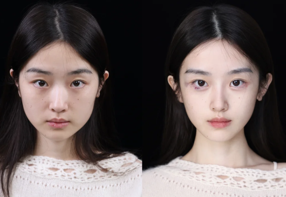 厦门领致医疗美容诊所擅长项目: