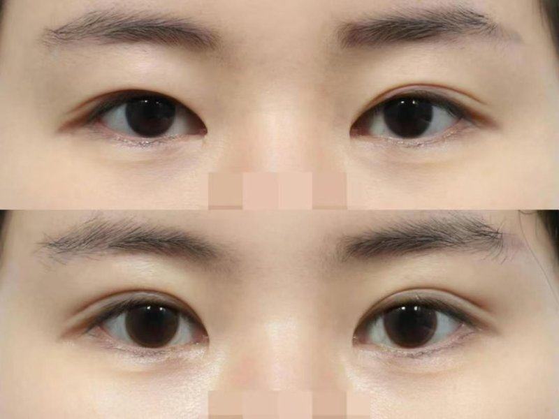 常州赫尔希医疗美容诊所价格表