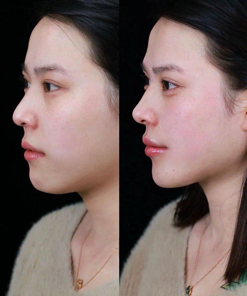 精细选择指南：按疤痕情况匹配良好方案