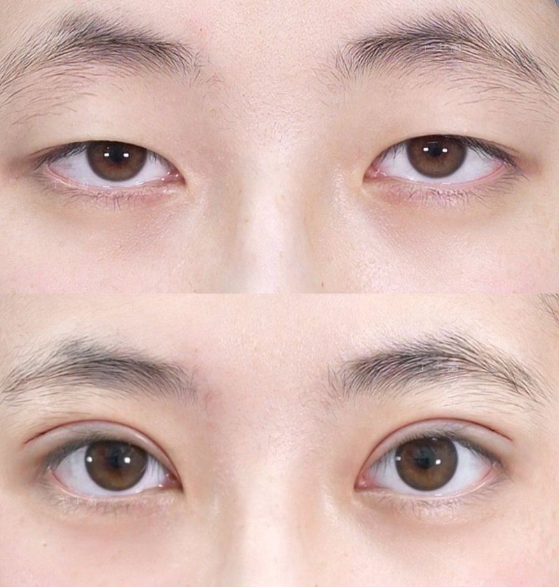 海口华韩国内外整形美容医院预约挂号方式：