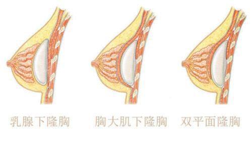 紧急情况:无需等待,及时就医修复