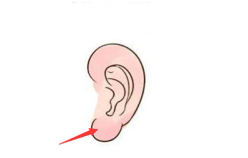 二、手术疤痕红色多久会变白?会不会更终变成白色?