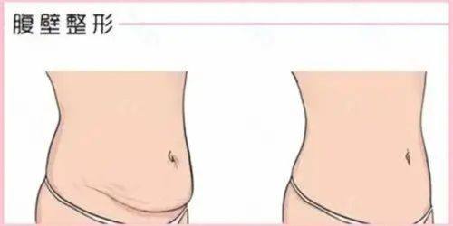 五、硅胶隆鼻的术后保护与随访服务