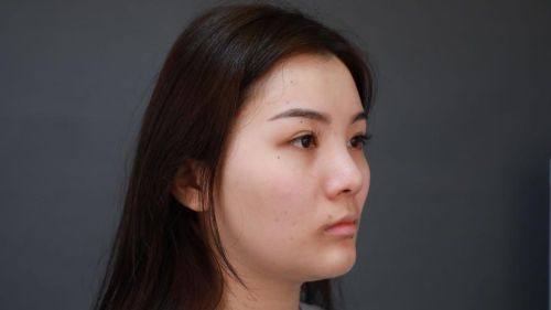 河南中医学校第一附属医院整形美容科擅长项目: