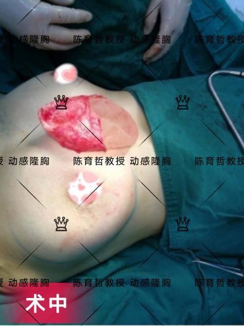 温州玉熙整形医疗美容医院口碑评价