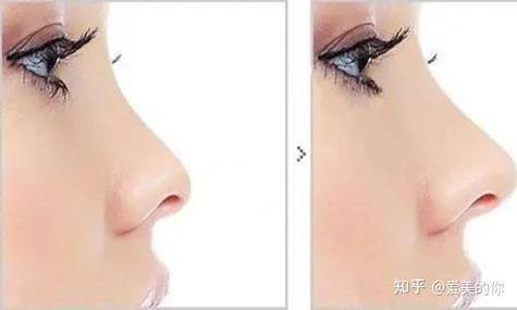 保定悦美医疗美容怎么样？