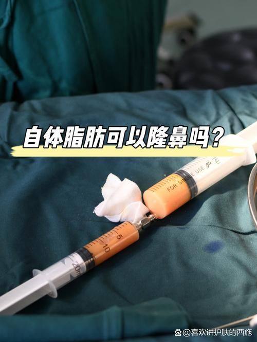 保定悦美医疗美容擅长项目：