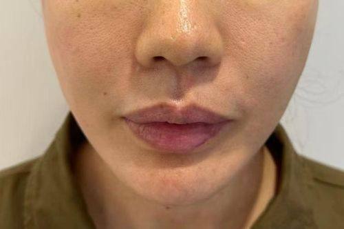 温州玉熙整形医疗美容医院地址电话及营业时间