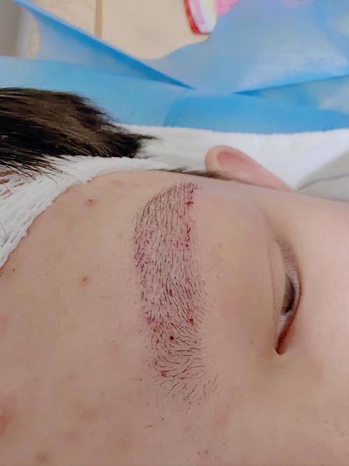 姚绚医生技术优势