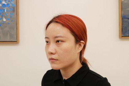 温州玉熙整形医疗美容医院价格表