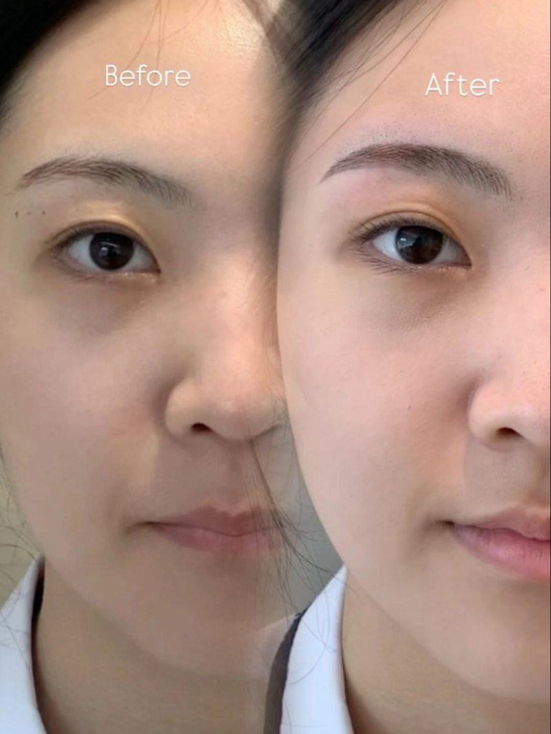 长沙笙美荟整形医院擅长项目：