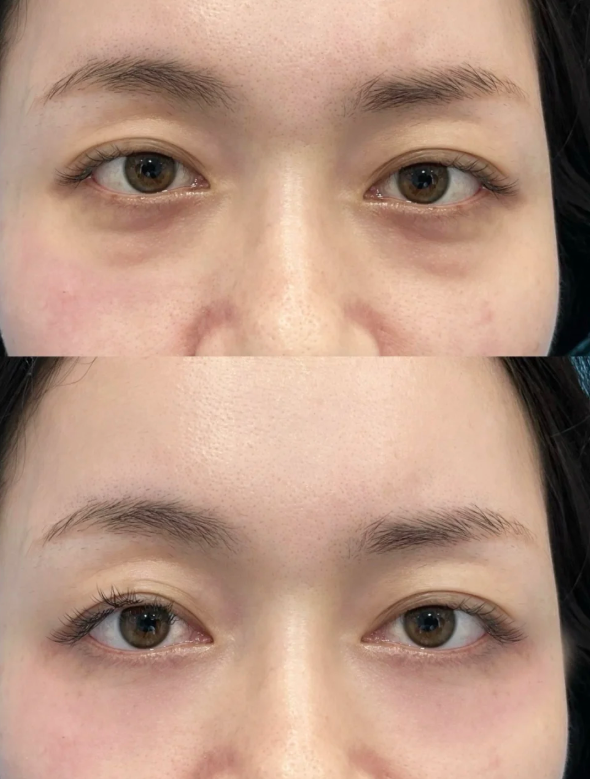 四、步骤式循环徒手按摩法,系统紧致眼周