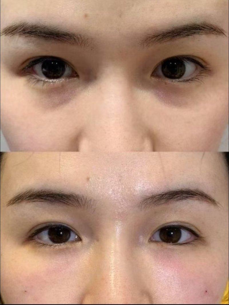 温州玉熙整形医疗美容医院预约挂号方式