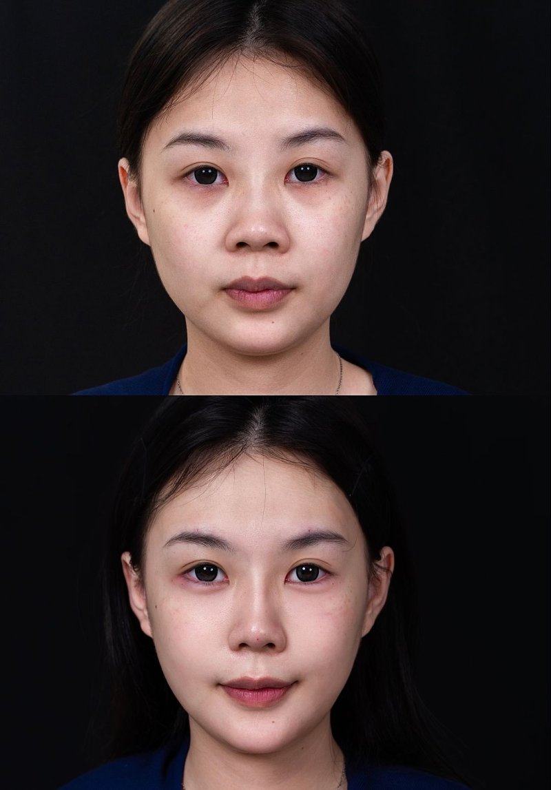 三、局部护理与感染预防要点