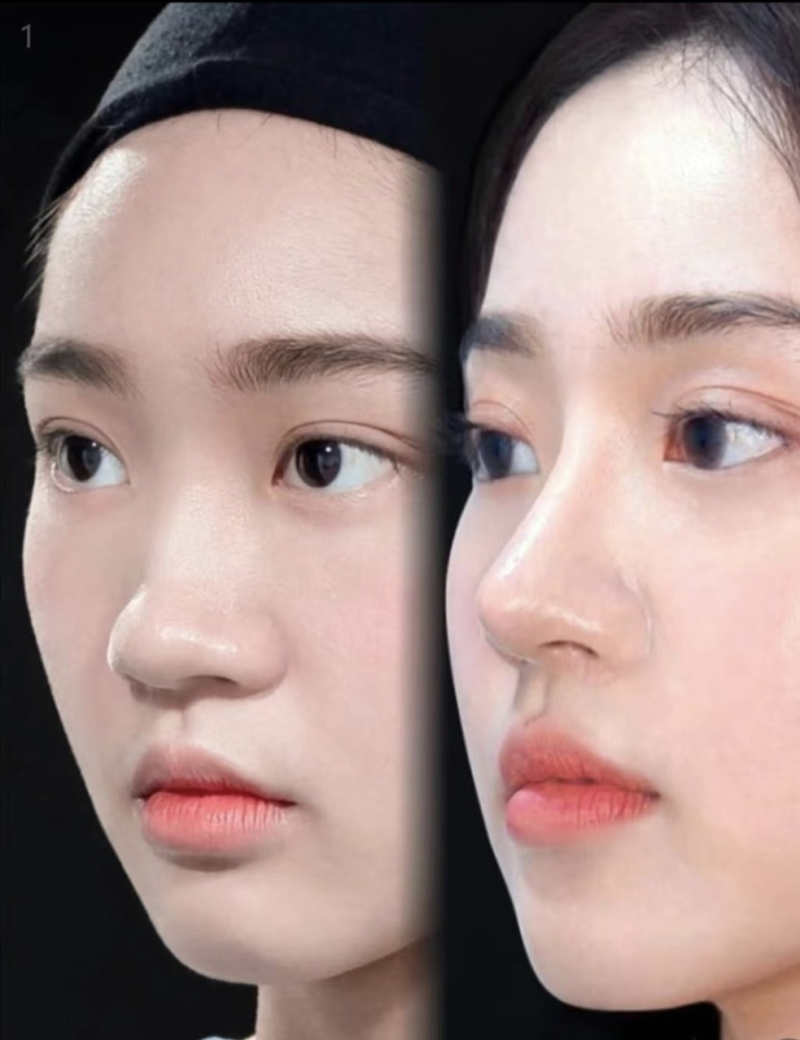 温州玉熙整形医疗美容医院怎么样