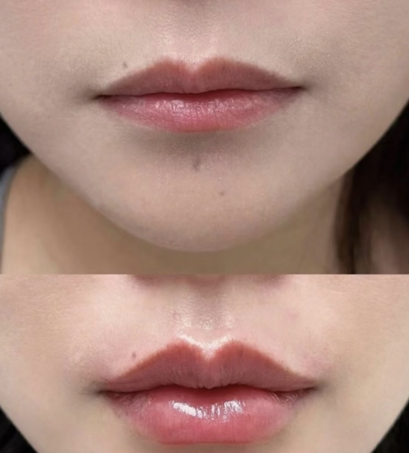 五、白毒瘦脸针对身体有害吗