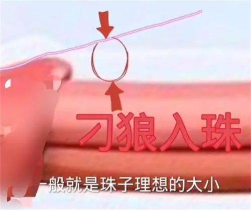 二、术后急性风险:血肿、感染与假体外露的应对与危害