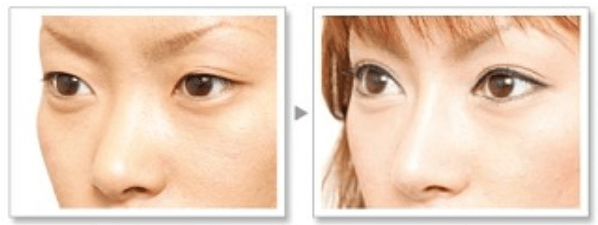 王肖琴医生擅长领域：