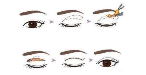 唐山市惠美登医疗美容诊所擅长项目：