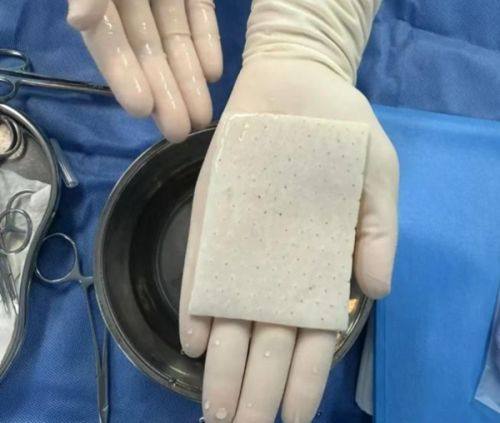 二、疤痕修复的阶段性变化，对应不同淡化周期