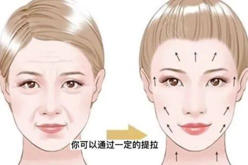 三、眼袋怎么消除简单方法用土豆片可吗