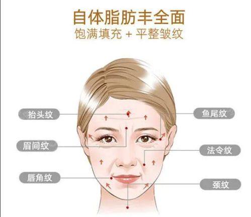 四、外切眼袋手术时长与术后修复的关联
