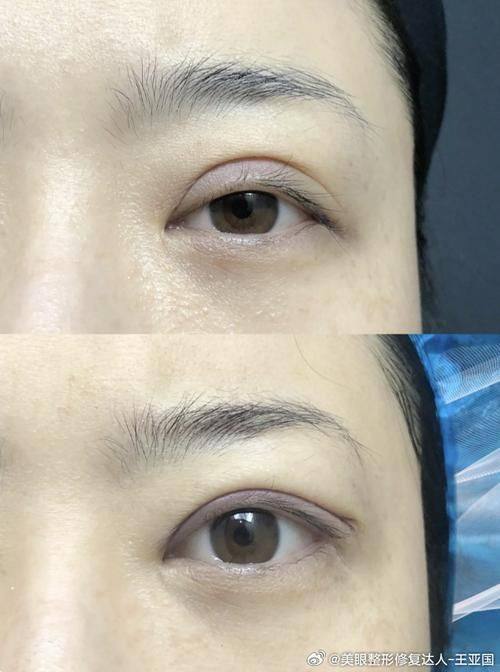 唐山市惠美登医疗美容诊所口碑评价：