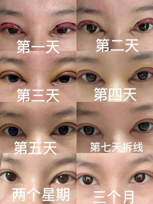 浙江上虞人民医院整形科价格表：