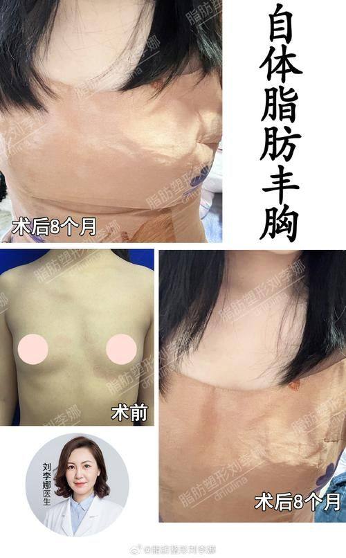 莆田永秀整形医疗美容预约挂号方式：