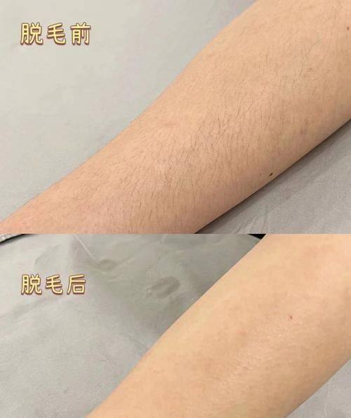 成都锦江颜玺整形医院口碑评价：