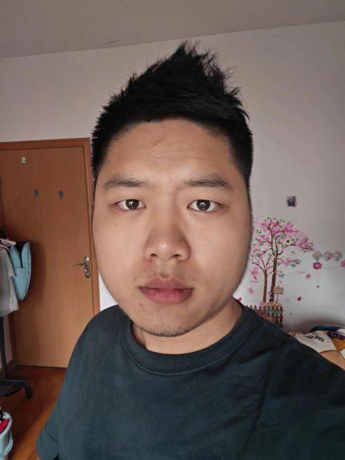 泉州碧莲盛植发预约挂号方式