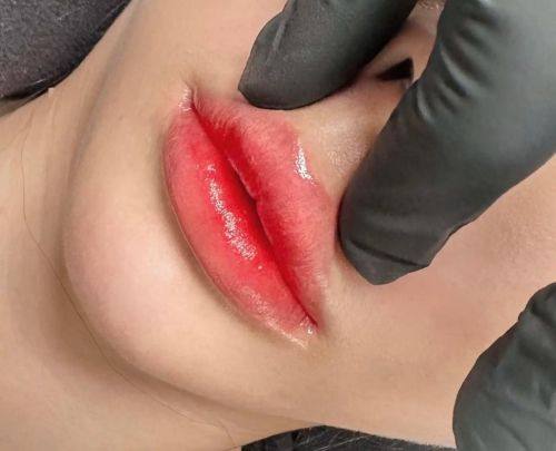 浙江上虞人民医院整形科口碑评价：