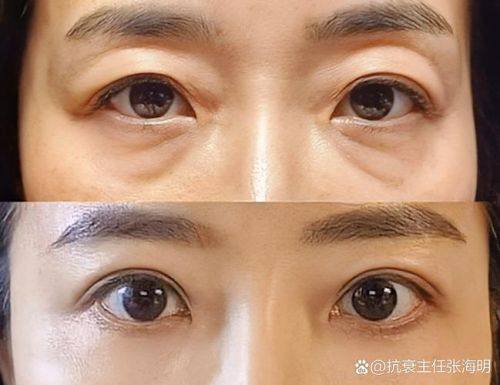 汪阳医生技术优势