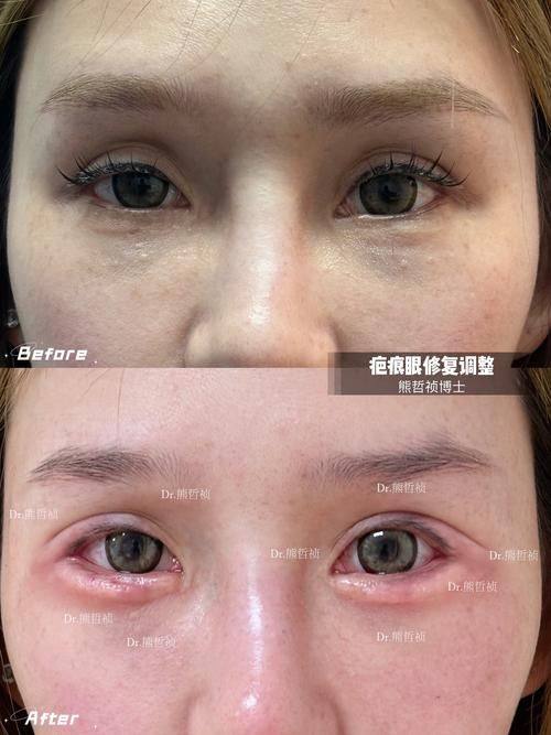 韩悦医生技术优势