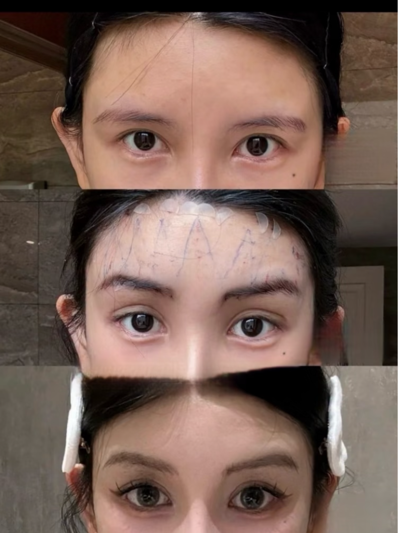 泉州碧莲盛植发口碑评价