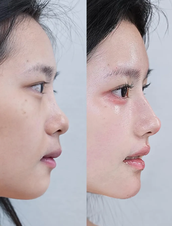 浙江上虞人民医院整形科怎么样？