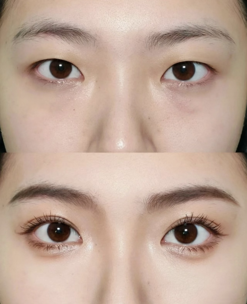 浙江上虞人民医院整形科医生名单及擅长领域：