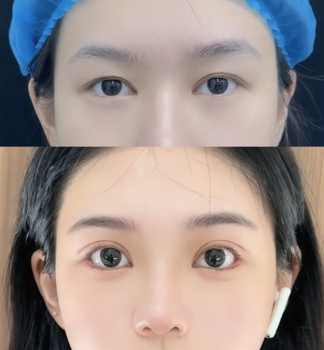 三、2岁宝宝脸上摔伤有疤痕吃什么药